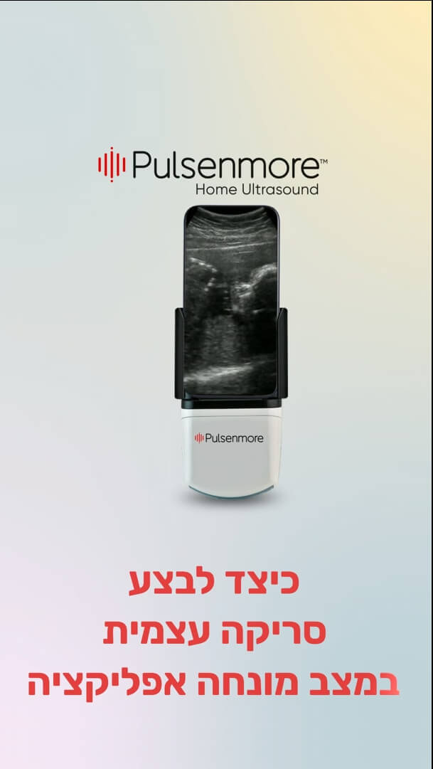 סרטון סריקת אולטרסאונד