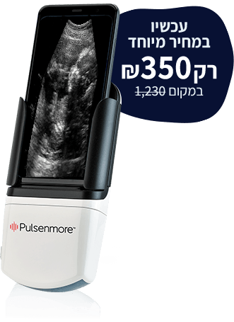 מכשיר במחיר מיוחד